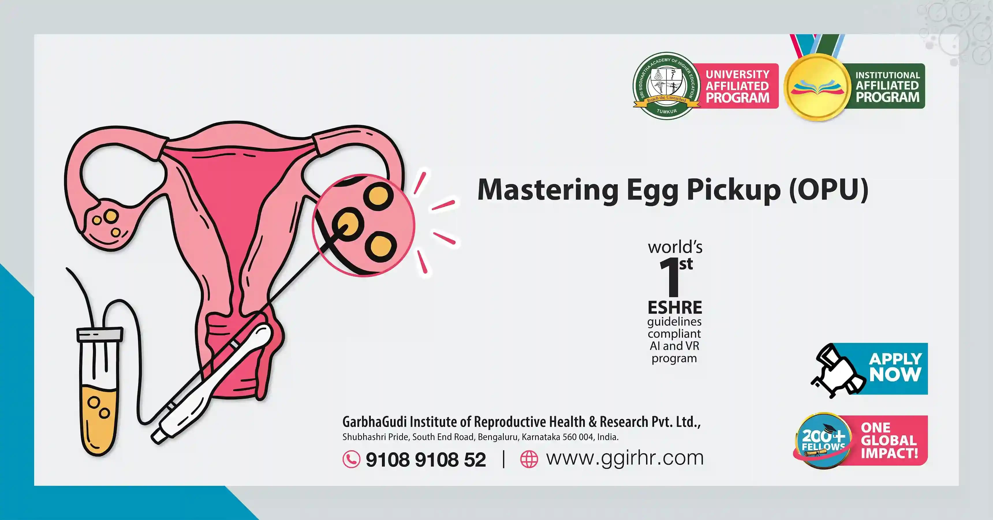 Mastering Egg Pickup [Oocyte Pickup; Ovum Pickup; OPU]